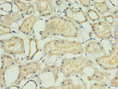 Immunohistochemistry of paraffin-embedded human testis tissue using CAC14282 at dilution of 1:100