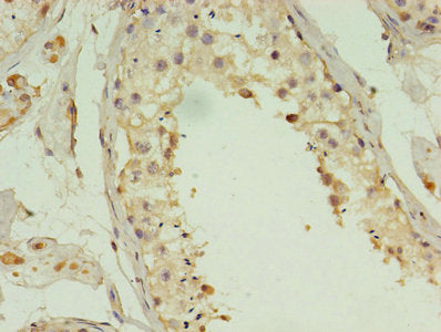 ACBD4 Polyclonal Antibody - image 4