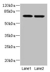 Immunohistochemistry of paraffin-embedded human adrenal gland tissue using CAC14283 at dilution of 1:100
