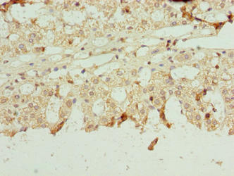 NETO2 Polyclonal Antibody - image 3