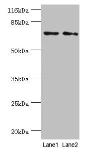 MAGEC3 Polyclonal Antibody - image 2