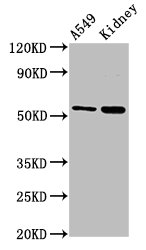 IHC image of CAC14290 diluted at 1:600 and staining in paraffin-embedded human liver cancer performed on a Leica BondTM system. After dewaxing and hydration, antigen retrieval was mediated by high pressure in a citrate buffer (pH 6.0). Section was blocked with 10% normal goat serum 30min at RT. Then primary antibody (1% BSA) was incubated at 4°C overnight. The primary is detected by a biotinylated secondary antibody and visualized using an HRP conjugated SP system.