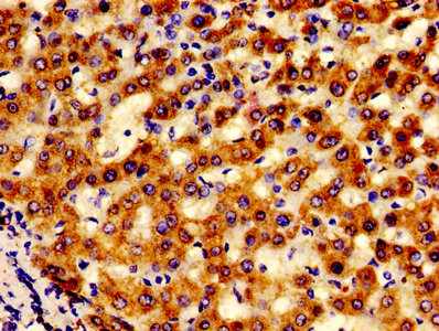 IHC image of CAC14290 diluted at 1:600 and staining in paraffin-embedded human kidney tissue performed on a Leica BondTM system. After dewaxing and hydration, antigen retrieval was mediated by high pressure in a citrate buffer (pH 6.0). Section was blocked with 10% normal goat serum 30min at RT. Then primary antibody (1% BSA) was incubated at 4°C overnight. The primary is detected by a biotinylated secondary antibody and visualized using an HRP conjugated SP system.