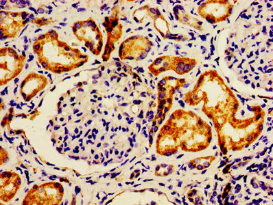 Immunofluorescence staining of HepG2 cells with CAC14290 at 1:200, counter-stained with DAPI. The cells were fixed in 4% formaldehyde, permeabilized using 0.2% Triton X-100 and blocked in 10% normal Goat Serum. The cells were then incubated with the antibody overnight at 4°C. The secondary antibody was Alexa Fluor 488-congugated AffiniPure Goat Anti-Rabbit IgG(H+L).