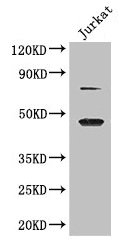 Immunofluorescent analysis of Hela cells using CAC14293 at dilution of 1:100 and Alexa Fluor 488-congugated AffiniPure Goat Anti-Rabbit IgG(H+L)