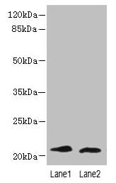 Immunohistochemistry of paraffin-embedded human testis tissue using CAC14299 at dilution of 1:100