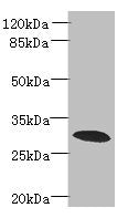 Immunohistochemistry of paraffin-embedded human kidney tissue using CAC14308 at dilution of 1:100