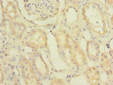 Immunohistochemistry of paraffin-embedded human liver tissue using CAC14308 at dilution of 1:100
