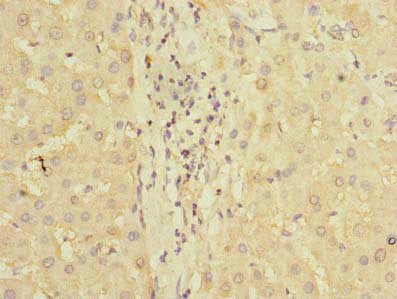 Immunofluorescent analysis of HepG2 cells using CAC14308 at dilution of 1:100 and Alexa Fluor 488-congugated AffiniPure Goat Anti-Rabbit IgG(H+L)