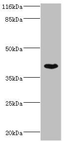 Immunohistochemistry of paraffin-embedded human pancreatic tissue using CAC14316 at dilution of 1:100