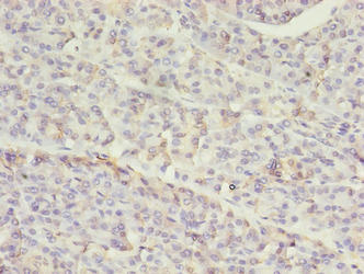 SETD7 Polyclonal Antibody - image 3