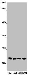 Immunohistochemistry of paraffin-embedded human liver tissue using CAC14319 at dilution of 1:100