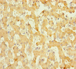 ABHD14B Polyclonal Antibody - image 3