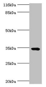 Immunohistochemistry of paraffin-embedded human testis tissue using CAC14323 at dilution of 1:100