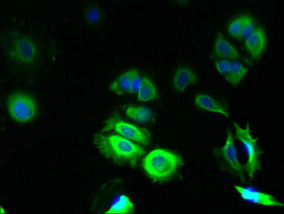 TMCO5A Polyclonal Antibody - image 4