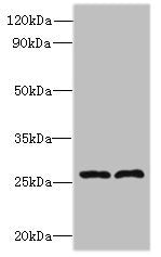 FAM71C Polyclonal Antibody - image 2