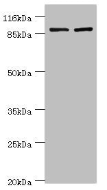 Immunohistochemistry of paraffin-embedded human colon cancer using CAC14334 at dilution of 1:100