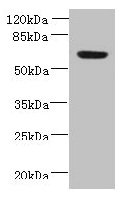 Immunohistochemistry of paraffin-embedded human colon cancer using CAC14340 at dilution of 1:100
