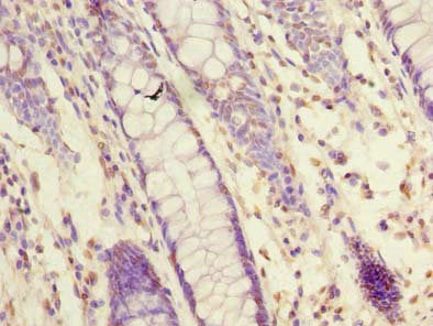Immunohistochemistry of paraffin-embedded human colon tissue using CAC14340 at dilution of 1:100