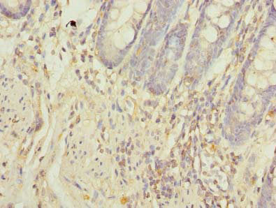 NXPE1 Polyclonal Antibody - image 4
