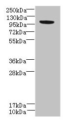 PPFIBP2 Polyclonal Antibody - image 2
