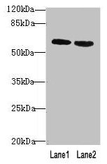 Immunohistochemistry of paraffin-embedded human small intestine tissue using CAC14349 at dilution of 1:100