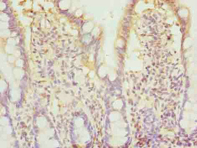 BTN2A2 Polyclonal Antibody - image 3