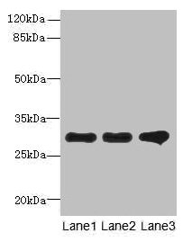 Immunohistochemistry of paraffin-embedded human skeletal muscle tissue using CAC14351 at dilution of 1:100