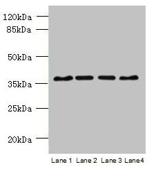 Immunohistochemistry of paraffin-embedded human placenta tissue using CAC14362 at dilution of 1:100