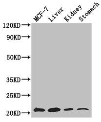 Immunohistochemistry of paraffin-embedded human gastric cancer using CAC14375 at dilution of 1:100