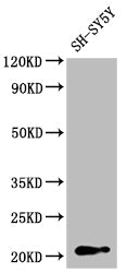GNPNAT1 Polyclonal Antibody - image 5