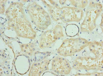 Immunofluorescent analysis of Hela cells using CAC14377 at dilution of 1:100 and Alexa Fluor 488-congugated AffiniPure Goat Anti-Rabbit IgG(H+L)