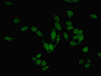 PRMT6 Polyclonal Antibody - image 4