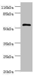 Immunohistochemistry of paraffin-embedded human colon cancer using CAC14381 at dilution of 1:100