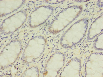 DPH2 Polyclonal Antibody - image 3