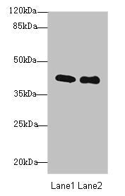 Immunofluorescent analysis of HepG2 cells using CAC14383 at dilution of 1:100 and Alexa Fluor 488-congugated AffiniPure Goat Anti-Rabbit IgG(H+L)