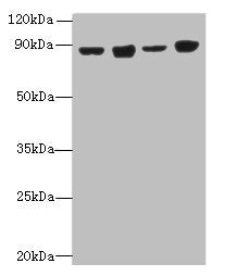 Immunohistochemistry of paraffin-embedded human thyroid tissue using CAC14385 at dilution of 1:100