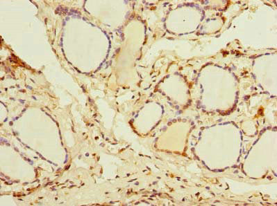 DDX50 Polyclonal Antibody - image 3