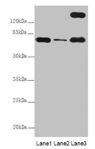 Immunohistochemistry of paraffin-embedded human thyroid tissue using CAC14389 at dilution of 1:100