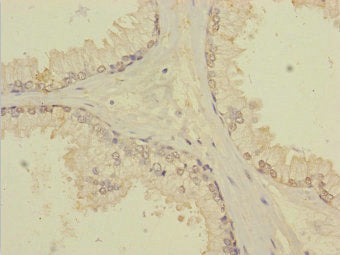 TTC12 Polyclonal Antibody - image 4