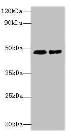 Immunohistochemistry of paraffin-embedded human lung cancer using CAC14391 at dilution of 1:100