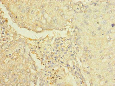 Immunohistochemistry of paraffin-embedded human testis tissue using CAC14391 at dilution of 1:100