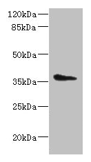 Immunohistochemistry of paraffin-embedded human testis tissue using CAC14404 at dilution of 1:100