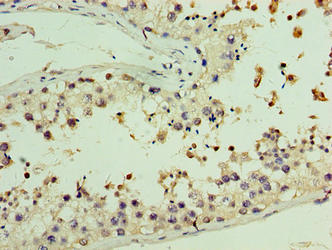 AASDHPPT Polyclonal Antibody - image 3