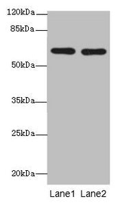 CNOT2 Polyclonal Antibody - image 2