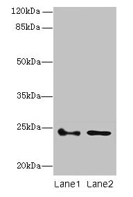 Immunohistochemistry of paraffin-embedded human colon cancer using CAC14412 at dilution of 1:100