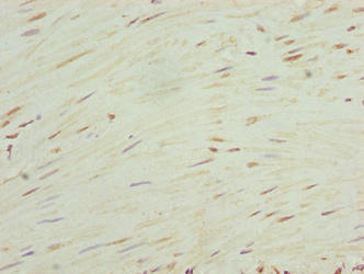 Immunohistochemistry of paraffin-embedded human small intestine tissue using CAC14412 at dilution of 1:100