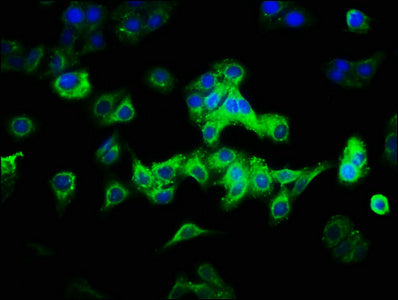 Western Blot, All lanes: CAB39L antibody at 10ug/ml + 293T whole cell lysate, Secondary, Goat polyclonal to rabbit IgG at 1/10000 dilution, Predicted band size: 40 kDa, Observed band size: 40 kDa