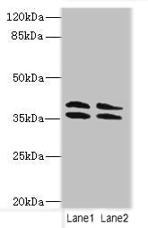CA10 Polyclonal Antibody - image 2