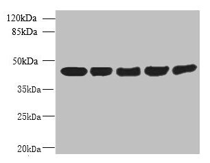 Immunohistochemistry of paraffin-embedded human testis tissue using CAC14450 at dilution of 1:100